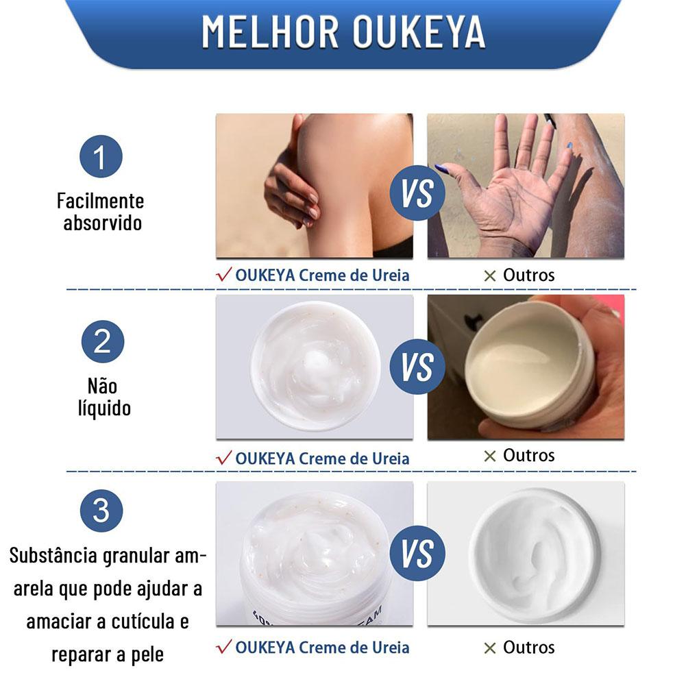 우레아 크림 40% 보습 안티드라이 핸드 풋 크림 굳은 - Urea Foot Cream 리뷰 및 가격