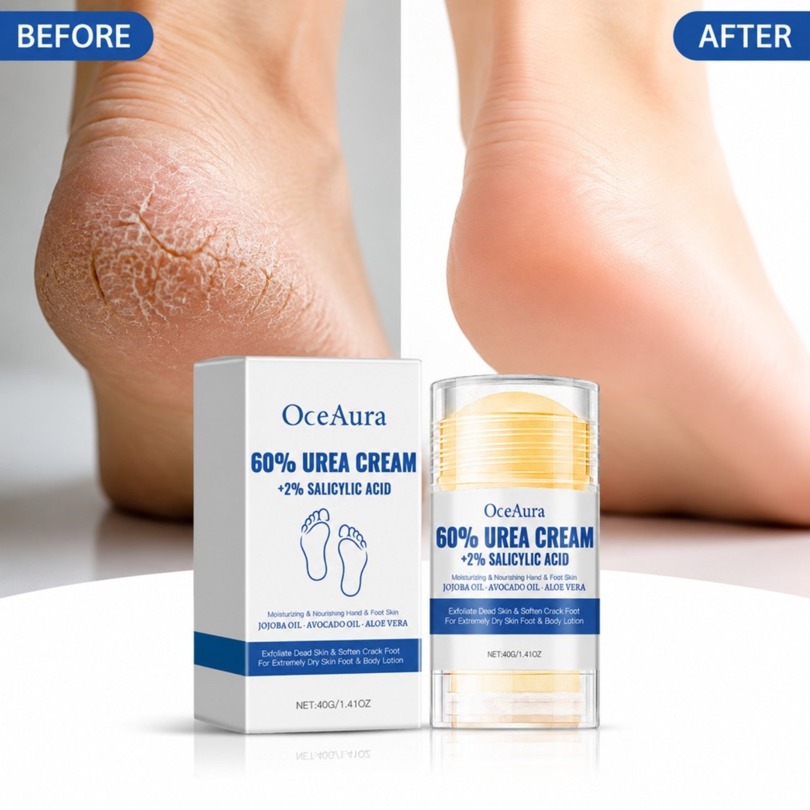 60% 우레아 풋 케어 크림 스틱 보습 및 각질 제거  - Urea Foot Cream 리뷰 및 가격